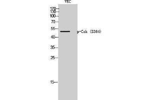 Western Blotting (WB) image for anti-C-Src tyrosine Kinase (CSK) (pSer364) antibody (ABIN3182195) (CSK antibody  (pSer364))