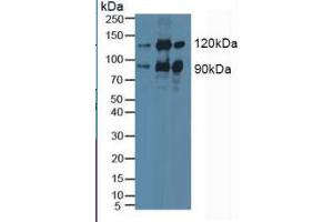 Western Blotting (WB) image for Protein Kinase C, epsilon (PRKCE) ELISA Kit (ABIN6574158)