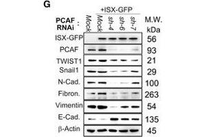 Western Blotting (WB) image for anti-Vimentin (VIM) antibody (ABIN2854814)