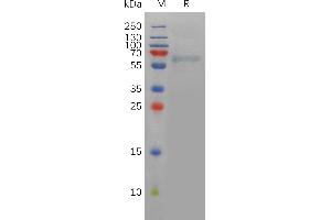 Human FURIN Protein, His Tag on SDS-PAGE under reducing condition. (FURIN Protein (AA 27-574) (His tag))