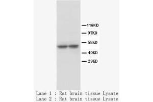 Image no. 1 for anti-Tryptophan Hydroxylase 1 (TPH1) antibody (ABIN1502010) (Tryptophan Hydroxylase 1 antibody)
