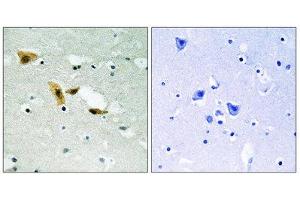Immunohistochemistry (IHC) image for anti-Aprataxin and PNKP Like Factor (APLF) (Ser116) antibody (ABIN1848316) (APLF antibody  (Ser116))
