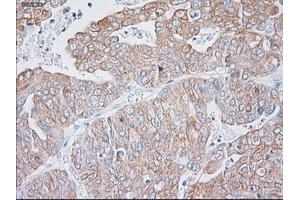 Immunohistochemical staining of paraffin-embedded Kidney tissue using anti-KRT19mouse monoclonal antibody. (Cytokeratin 19 antibody  (AA 240-390))