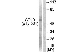 Western blot analysis of extracts from COS7 cells, treated with Serum (10%, 30mins), using CD19 (Phospho-Tyr531) Antibody. (CD19 antibody  (pTyr531))