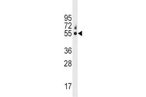 Western Blotting (WB) image for anti-Cytochrome P450, Family 3, Subfamily A, Polypeptide 5 (CYP3A5) antibody (ABIN3003497) (CYP3A5 antibody)