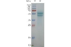 Human A-Nanodisc, Flag Tag on SDS-PAGE (ADRB1 Protein)
