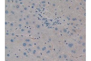 DAB staining on IHC-P; Samples: Human Liver Tissue (CTHRC1 antibody  (AA 31-243))