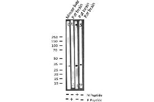 Western blot analysis of Phospho-NPM (Thr199) expression in various lysates (NPM1 antibody  (pThr199))
