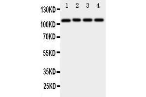 Anti-ADAM19 antibody, Western blotting Lane 1: Rat Spleen Tissue Lysate Lane 2: Rat Intestine Tissue Lysate Lane 3: Rat Brain Tissue Lysate Lane 4: HELA Cell Lysate (ADAM19 antibody  (N-Term))