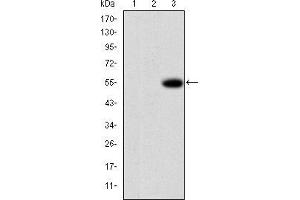 Western Blotting (WB) image for anti-Matrix Metallopeptidase 9 (Gelatinase B, 92kDa Gelatinase, 92kDa Type IV Collagenase) (MMP9) antibody (ABIN969288)