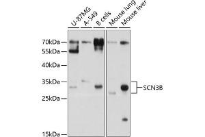Western blot analysis of extracts of various cell lines, using SCN3B antibody (ABIN6133255, ABIN6147441, ABIN6147442 and ABIN6214525) at 1:1000 dilution. (SCN3B antibody  (AA 23-160))