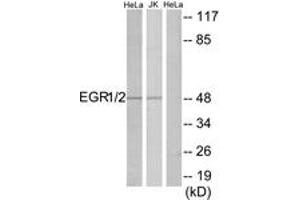 Western blot analysis of extracts from HeLa/Jurkat cells, using EGR1/2 Antibody. (EGR1 + EGR2 (AA 371-420) antibody)