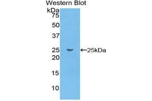 Western Blotting (WB) image for anti-Glutathione S-Transferase pi 1 (GSTP1) (AA 1-210) antibody (ABIN1078086) (GSTP1 antibody  (AA 1-210))