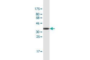 Western Blot detection against Immunogen (36. (FBXO11 antibody  (AA 744-843))