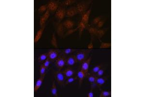 Immunofluorescence analysis of NIH-3T3 cells using PSMD4 Rabbit mAb (ABIN1681255, ABIN3017957, ABIN3017958 and ABIN7101547) at dilution of 1:100 (40x lens). (PSMD4/ASF antibody)