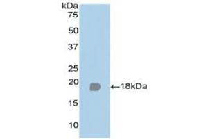 Western blot analysis of recombinant Human PPARg. (PPARG antibody  (AA 349-488))