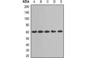 Western blot analysis of TAB1 expression in MCF7 (A), A431 (B), Hela (C), mouse kidney (D), mouse heart (E) whole cell lysates. (TAB1 antibody)