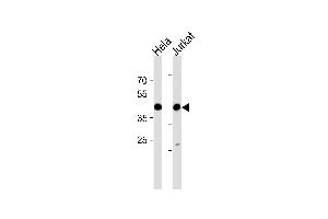 Western blot analysis in Hela and Jurkat cell line lysates (35ug/lane). (MAPK14 antibody  (AA 158-187))
