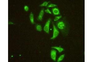 Detection of MAP4 in Hela cells using Polyclonal Antibody to Microtubule Associated Protein 4 (MAP4) (MAP4 antibody  (AA 2-250))