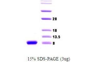 Figure annotation denotes ug of protein loaded and % gel used. (alpha Synuclein 195 (active) Protein)