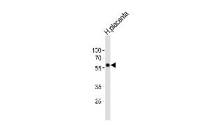 Western blot analysis of lysate from human placenta tissue lysate, using FOXO4 Antibody (C-term) (ABIN6242148 and ABIN6577869). (FOXO4 antibody  (C-Term))