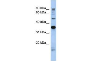 WB Suggested Anti-MGC70924 Antibody Titration: 0. (PRR19 antibody  (N-Term))