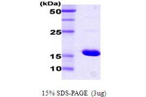 SDS-PAGE (SDS) image for DnaK (AA 385-546) protein (ABIN666828) (DnaK (AA 385-546) Protein)