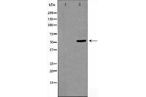 Western blot analysis of extracts from HeLa cells using CELF-1 antibody. (CELF1 antibody  (N-Term))