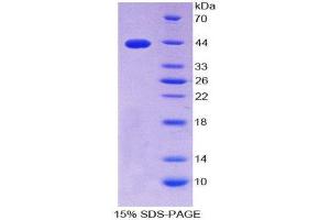 SDS-PAGE (SDS) image for S100 Calcium Binding Protein B (S100B) (AA 1-92) protein (His tag,GST tag) (ABIN2123575) (S100B Protein (AA 1-92) (His tag,GST tag))