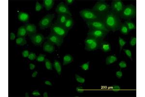 Immunofluorescence of monoclonal antibody to SNAI2 on HeLa cell. (SLUG antibody  (AA 97-169))