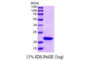 Figure annotation denotes ug of protein loaded and % gel used. (SlyD (AA 1-196) (Active) Protein)