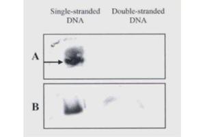 Western blot analysis showing context recognition. (N6-Methyladenosine antibody)