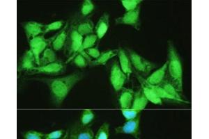 Immunofluorescence analysis of U2OS cells using KDM7A Polyclonal Antibody at dilution of 1:100. (JHDM1D antibody)