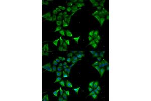 Immunofluorescence analysis of HeLa cell using CD177 antibody. (CD177 antibody)