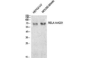 Western Blot (WB) analysis of HepG2-UV, Mouse Brain cells using Acetyl-NFkappaB-p65 (K221) Polyclonal Antibody. (NF-kB p65 antibody  (acLys221))
