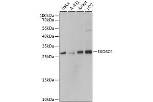 Western blot analysis of extracts of various cell lines, using EXOSC4 antibody  at 1:3000 dilution. (EXOSC4 antibody  (AA 1-245))