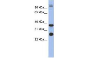 Image no. 1 for anti-Biglycan (BGN) (AA 215-264) antibody (ABIN6744047) (Biglycan antibody  (AA 215-264))