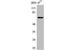 Western Blot analysis of HeLa cells using Phospho-Paxillin (Y31) Polyclonal Antibody (Paxillin antibody  (pTyr31))