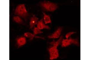 ABIN6267221 staining HeLa by IF/ICC. (CHEK1 antibody  (pSer296))