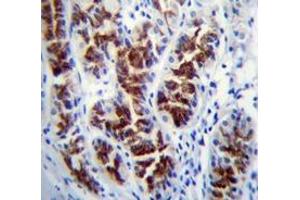 Immunohistochemistry analysis in human stomach tissue (Formalin-fixed, Paraffin-embedded) using PTPN20  Antibody , followed by peroxidase conjugated secondary antibody and DAB staining. (PTPN20 antibody  (Middle Region))