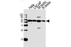 Lane 1: HeLa Cell lysates, Lane 2: LNCaP Cell lysates, Lane 3: Mouse testis lysates, Lane 4: Rat testis lysates, probed with ULK3 (1404CT148. (ULK3 antibody)