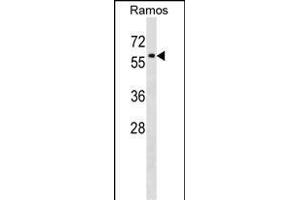 P4HA1 Antibody (C-term) (ABIN1537300 and ABIN2848732) western blot analysis in Ramos cell line lysates (35 μg/lane). (P4HA1 antibody  (C-Term))