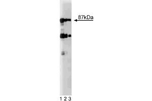 Western blot analysis of Dystrobrevin on rat brain lysate. (Dystrobrevin (AA 249-403) antibody)