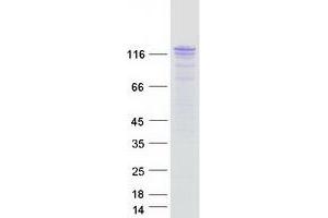 Validation with Western Blot (ESYT1 Protein (Myc-DYKDDDDK Tag))