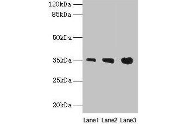 PVRIG antibody  (AA 193-326)