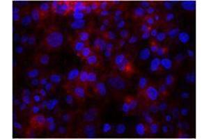 Immunofluorescence (IF) image for anti-Integrin beta 3 (ITGB3) antibody (ABIN2664787) (Integrin beta 3 antibody)