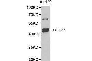 Western blot analysis of extracts of BT474 cell line, using CD177 antibody. (CD177 antibody)