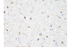 Immunohistochemistry of paraffin-embedded rat brain using MAPK14 antibody (ABIN6291833) at dilution of 1:100 (40x lens). (MAPK14 antibody)