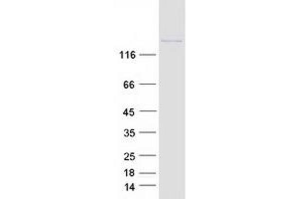 Synaptojanin 1 Protein (SYNJ1) (Transcript Variant 3) (Myc-DYKDDDDK Tag)