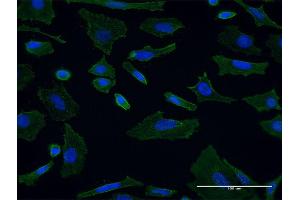 Immunofluorescence of monoclonal antibody to SH3GL1 on HeLa cell. (SH3GL1 antibody  (AA 1-369))